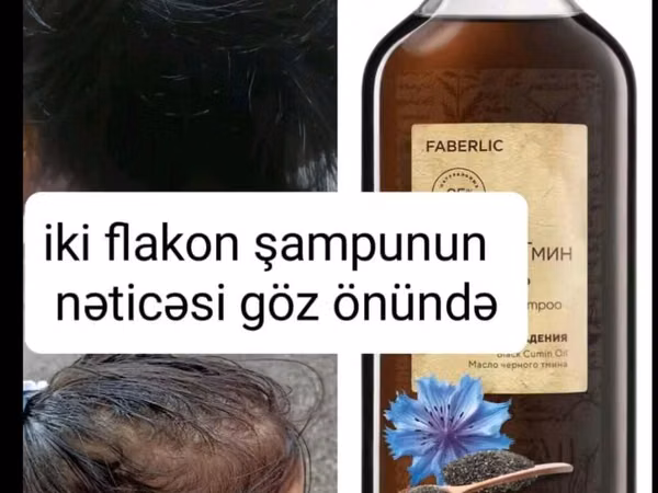 Kim istəsə sifariş edə bilər